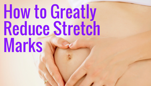 How To Reduce Unsightly Stretch Marks Using Clinically Proven Ingredients